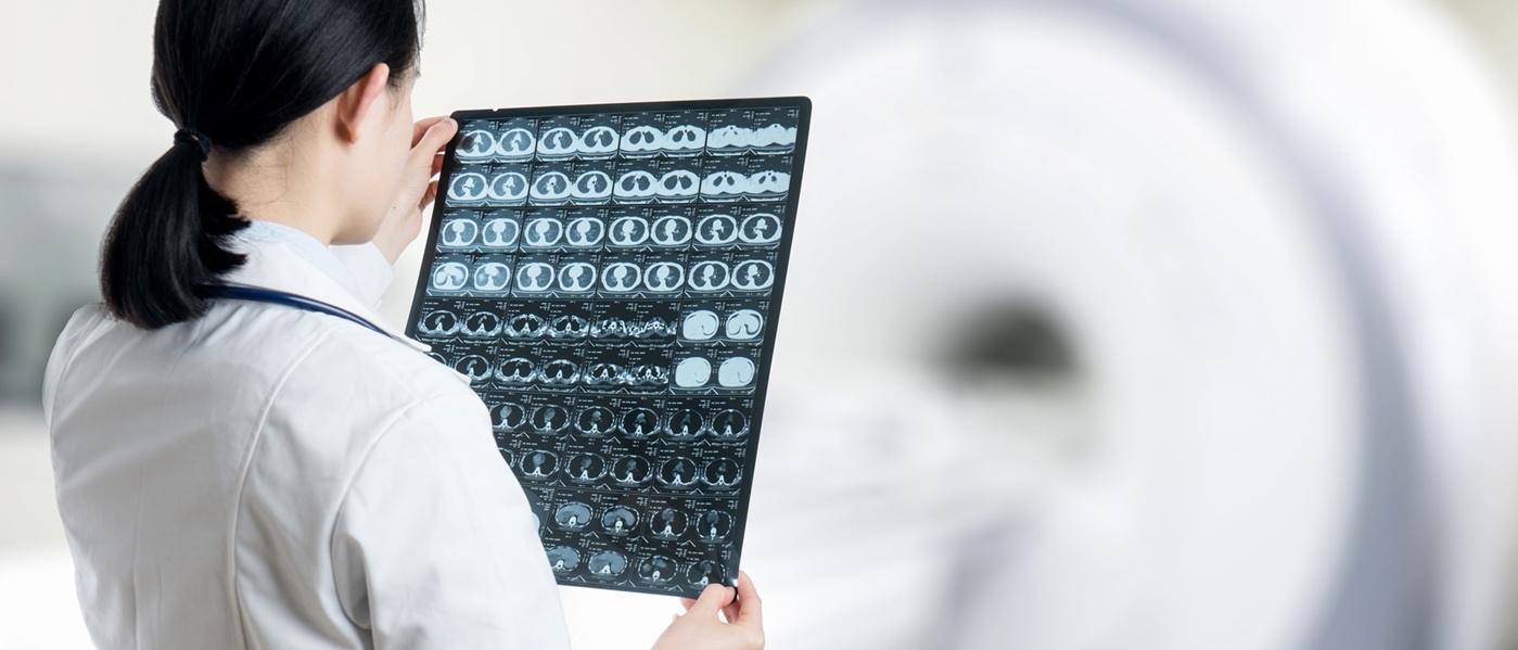 The Present and Future of Lung Cancer Screening present-future-lung-cancer-screening