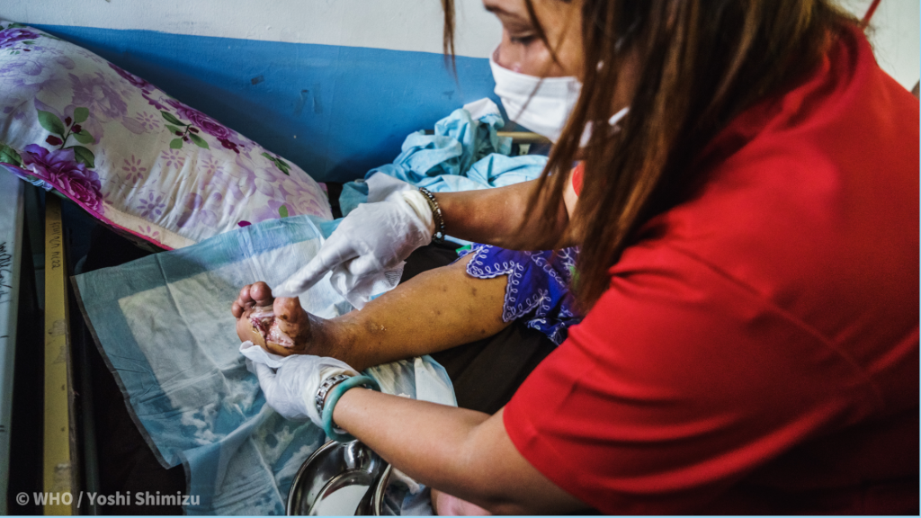 Wound management in resource-limited settings: Training for national and district-level health workers H0065EN