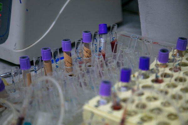 Basic fundamentals of in vitro diagnostics medical devices regulation – a global approach H0111EN